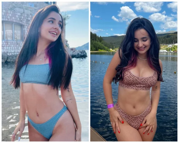 Анна Трінчер до і після пластики