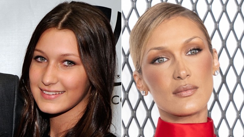 Белла Хадід до і після пластики