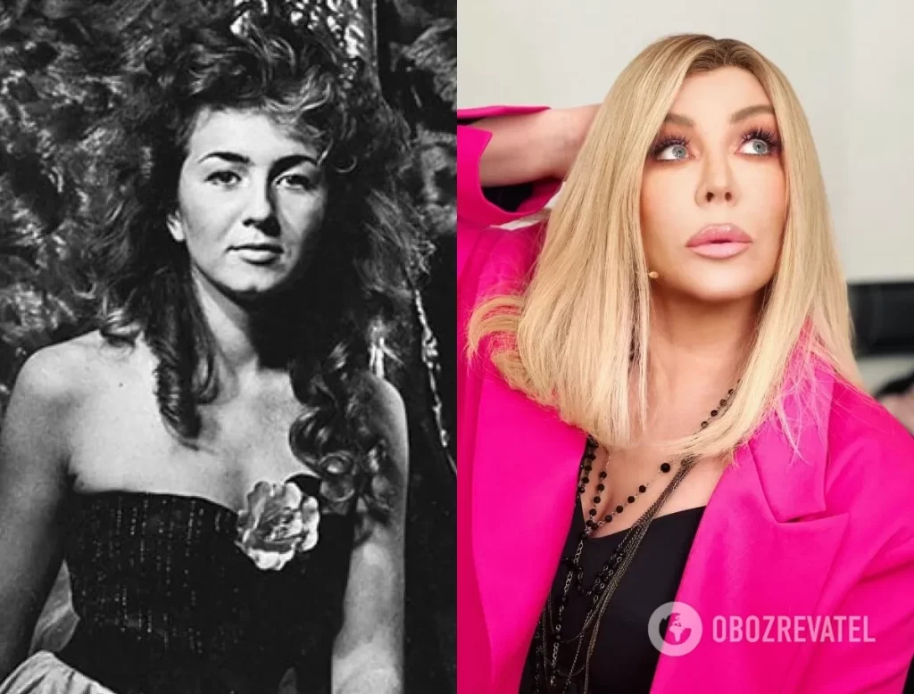 Ірина Білик пластичні операції фото до і після