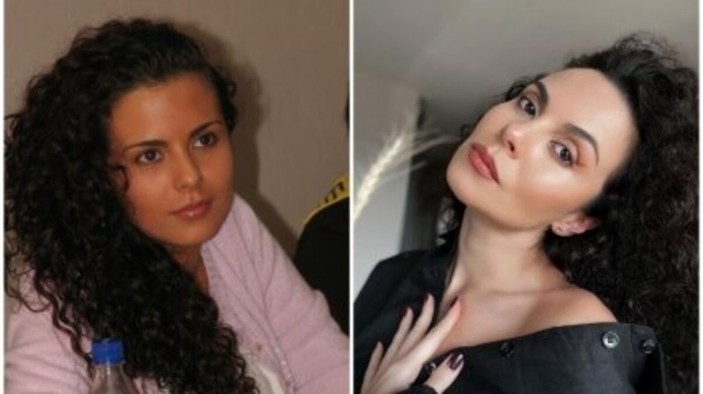 Настя Каменських до і після пластики