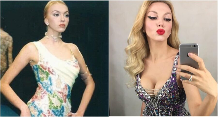 Оля Полякова пластика