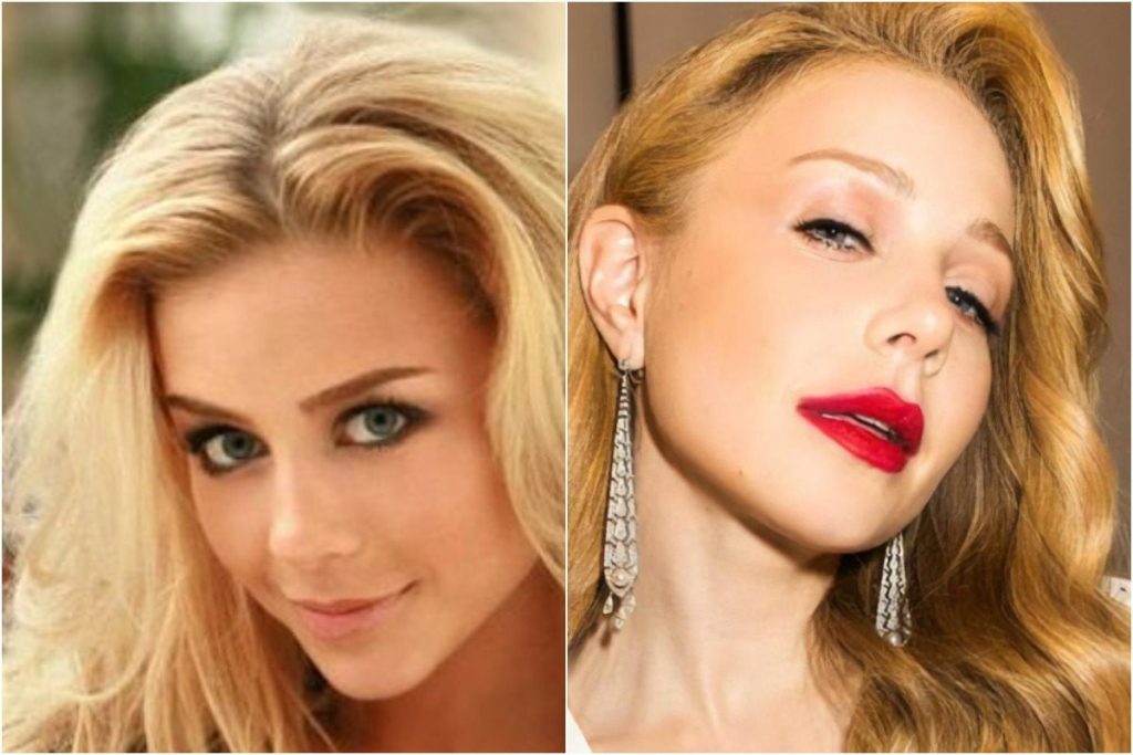 Тіна Кароль до і після пластики